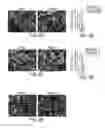 Fig. 08 - Identification of a 5-Gene Expression Signature Predicting Clinical Outcome of Patients with Brain Tumors