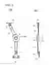 Fig. 03 - Stay