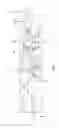 Fig. 05 - Valve arrangement and method of operating the same