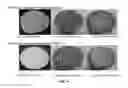 Fig. 04 - METHOD FOR ENHANCING ACIDIZING TREATMENT OF A FORMATION HAVING A HIGH BOTTOM HOLE TEMPERATURE