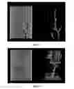 Fig. 07 - METHOD FOR ENHANCING ACIDIZING TREATMENT OF A FORMATION HAVING A HIGH BOTTOM HOLE TEMPERATURE