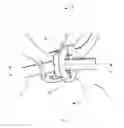 Fig. 02 - Clamping device for a wire element