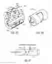 Fig. 02 - Methods and apparatus for ultrasonic fluid flow measurement and fluid flow data analysis