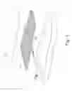 Fig. 02 - Lower limb force sensing system