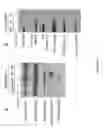 Fig. 02 - Type 2 diabetes biomarkers and uses thereof