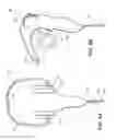 Fig. 06 - Illuminable transmission cable