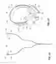 Fig. 07 - Illuminable transmission cable