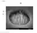 Fig. 05 - Digital X-ray source