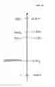 Fig. 13 - Metal battery having liquid anode and liquid cathode