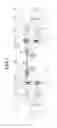 Fig. 03 - Deviation compensation method of potential transformer