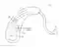 Fig. 01 - WIRELESS CHARGING SYSTEM FOR HEARING INSTRUMENTS