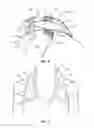 Fig. 07 - HALTER TOP WITH ATTACHABLE ACCESSORIES