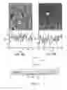 Fig. 12 - Contact-type endoscope SERS probe, and related methods