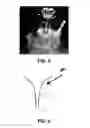 Fig. 07 - Hyperdrive and Neuroprobes for Stimulation Purposes