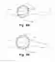 Fig. 09 - EXPANDABLE CAGE SURROUNDING A MAGNETIC RESONANCE DEVICE AND METHODS THEREOF