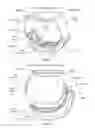 Fig. 03 - Electrocardiogram watch clasp