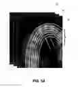 Fig. 04 - Method for teeth segmentation and alignment detection in CBCT volume