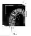 Fig. 06 - Method for teeth segmentation and alignment detection in CBCT volume