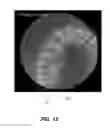 Fig. 20 - Method for teeth segmentation and alignment detection in CBCT volume