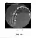 Fig. 22 - Method for teeth segmentation and alignment detection in CBCT volume
