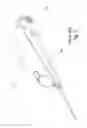 Fig. 02 - Biopsy with marker device and method
