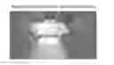 Fig. 01 - Retractor/stabilizer for excessive and/or redundant tissue and method of use