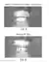 Fig. 05 - Retractor/stabilizer for excessive and/or redundant tissue and method of use
