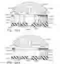 Fig. 152 - Stapling assemblies comprising a layer