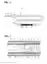 Fig. 02 - Detachable coil release system and handle assembly