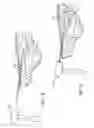 Fig. 07 - Apparatus for and method of providing a hip replacement