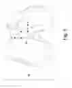 Fig. 09 - Customized patient-specific orthopaedic pin guides