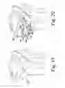Fig. 14 - Customized patient-specific orthopaedic pin guides