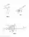 Fig. 05 - Trigger lockout and kickback mechanism for surgical instruments