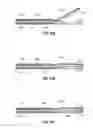 Fig. 09 - Trigger lockout and kickback mechanism for surgical instruments