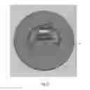 Fig. 06 - Minimally invasive laparoscopic tissue removal device