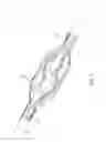 Fig. 11 - Method and apparatus for placing a catheter within a vasculature