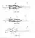 Fig. 19 - Method and apparatus for placing a catheter within a vasculature