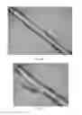Fig. 11 - Expandable atherectomy device