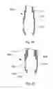 Fig. 14 - Expandable atherectomy device