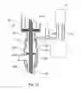 Fig. 15 - Expandable atherectomy device