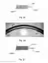 Fig. 17 - Expandable atherectomy device