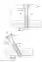 Fig. 03 - Hybrid cannula and methods for manufacturing the same