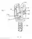 Fig. 04 - Bone screw assembly