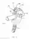 Fig. 06 - Bone screw assembly
