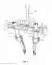 Fig. 02 - SPINAL CORRECTION SYSTEM