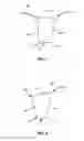 Fig. 07 - SPINAL CORRECTION SYSTEM