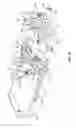 Fig. 09 - SPINAL CORRECTION SYSTEM