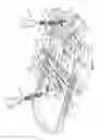 Fig. 13 - SPINAL CORRECTION SYSTEM