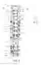 Fig. 02 - Spinal correction and secondary stabilization
