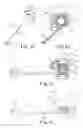 Fig. 07 - Spinal correction and secondary stabilization